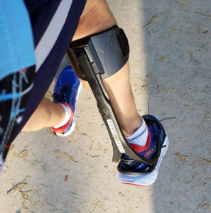 Endurance athlete Pete Armas uses leg braces to help him walk and run after being struck by a drunk driver