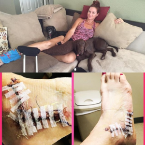 Gina Nofzinger recovering from ankle surgery